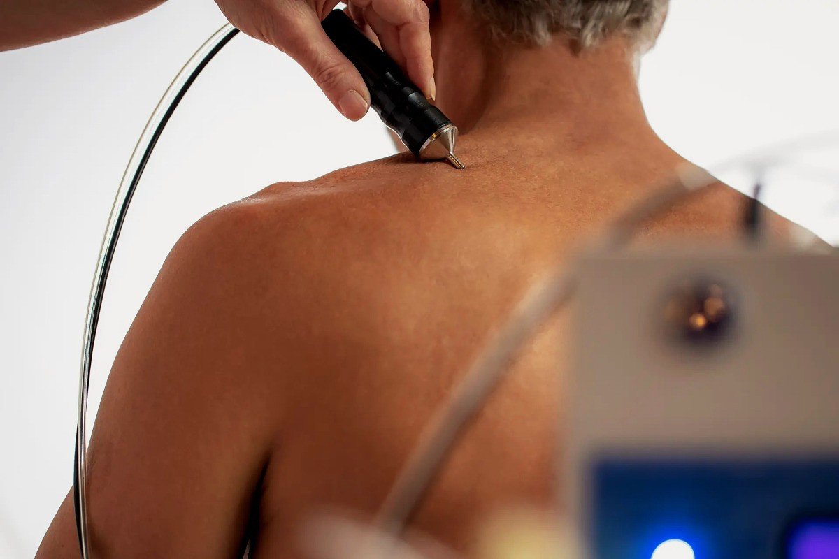 Energetic DERMA treatment stay